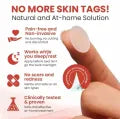 Derma Smooth Skin Tag Removal Patch